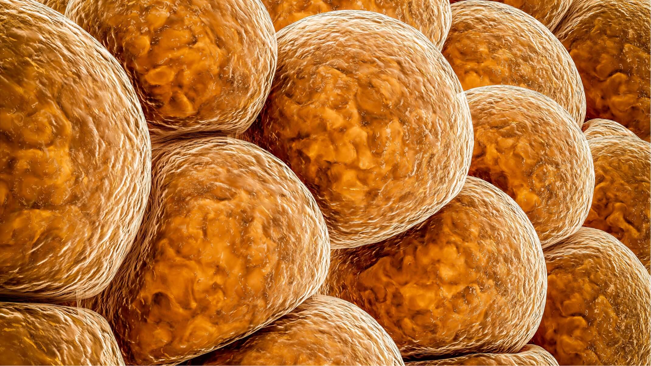 les causes et consequences du cholesterol